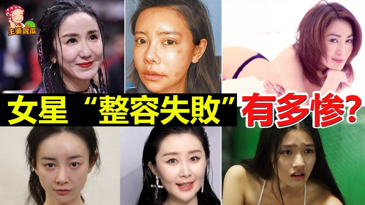 深度解析：整容很好看的女明星，如何做到自然美的典范？